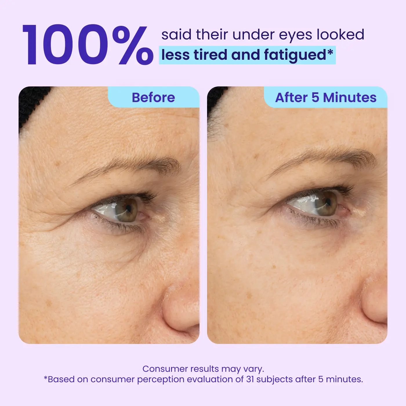 QIAWI® Eye Bag Instant Eraser, Tightens, Firms & Blurs Wrinkles