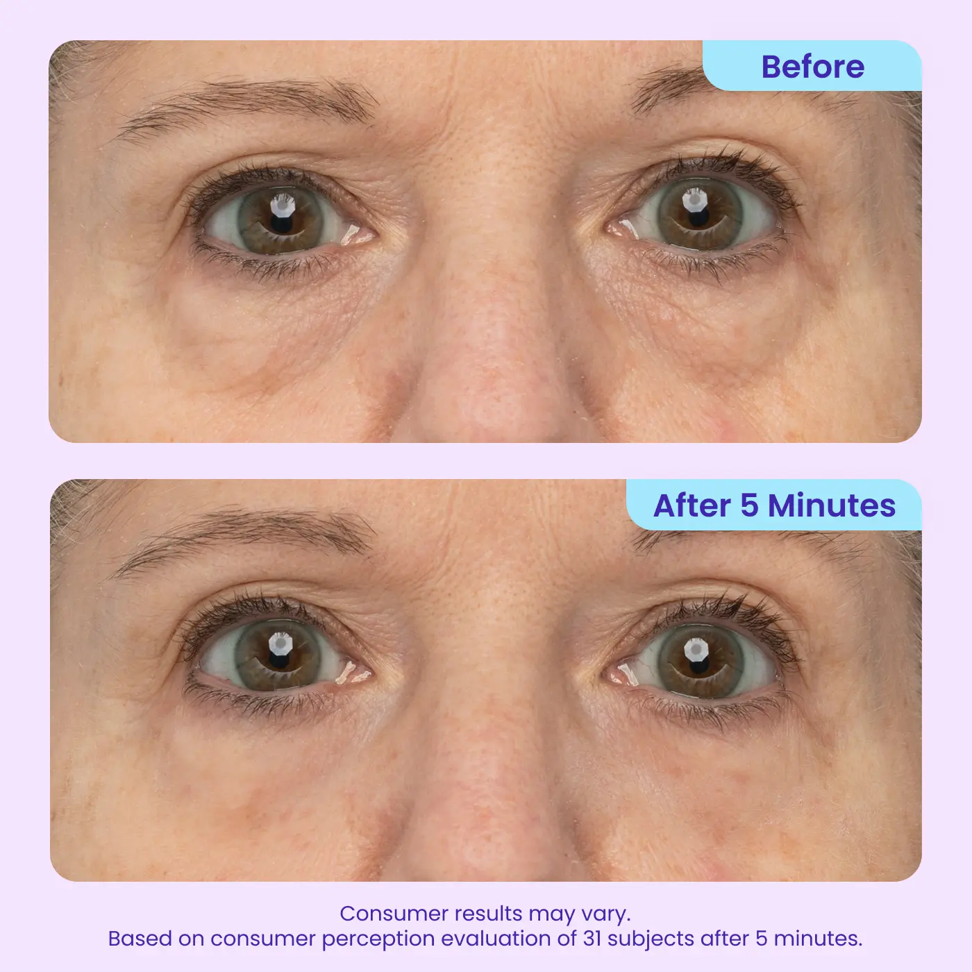 QIAWI® Eye Bag Instant Eraser, Tightens, Firms & Blurs Wrinkles