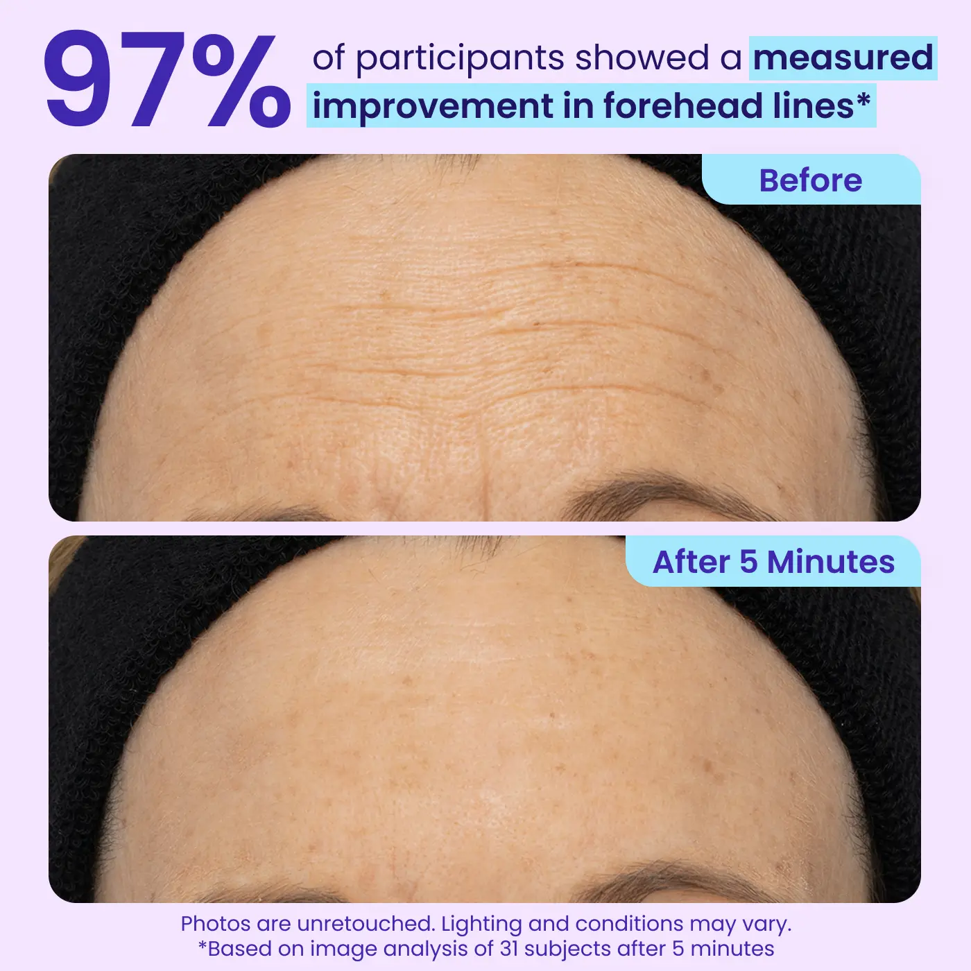 QIAWI® Eye Bag Instant Eraser, Tightens, Firms & Blurs Wrinkles