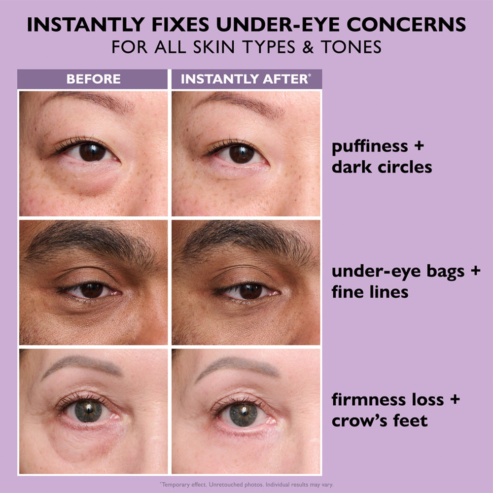 QIAWI® Eye Bag Instant Eraser, Tightens, Firms & Blurs Wrinkles
