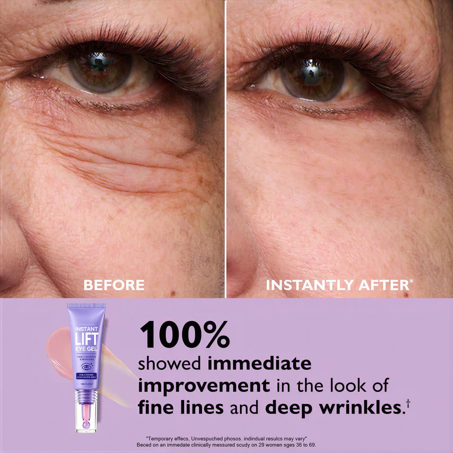 QIAWI® Eye Bag Instant Eraser, Tightens, Firms & Blurs Wrinkles