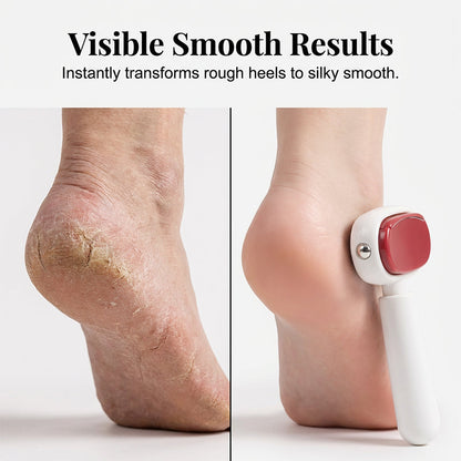 🥳HOT SALE🥳💞15K+ SOLD! Foot Scraper – Premium steel, dual surfaces & travel-ready
